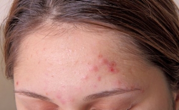 9 dấu hiệu cảnh báo cơ thể cần thải độc